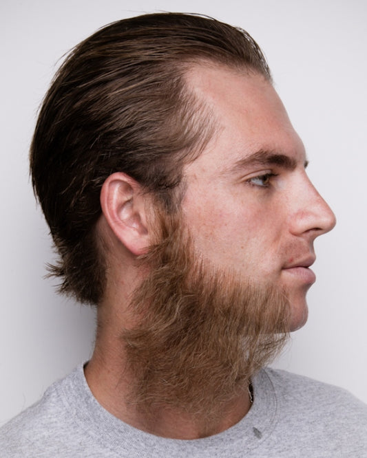 Very Large Sideburns